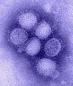 H1N1-virus